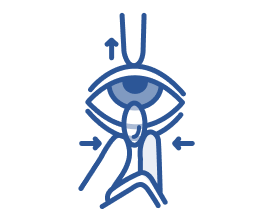 Illustration of a person inserting a contact lens by gently holding the upper and lower eyelids open and placing the lens on the eye with steady hands